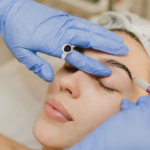 brow lift San Diego