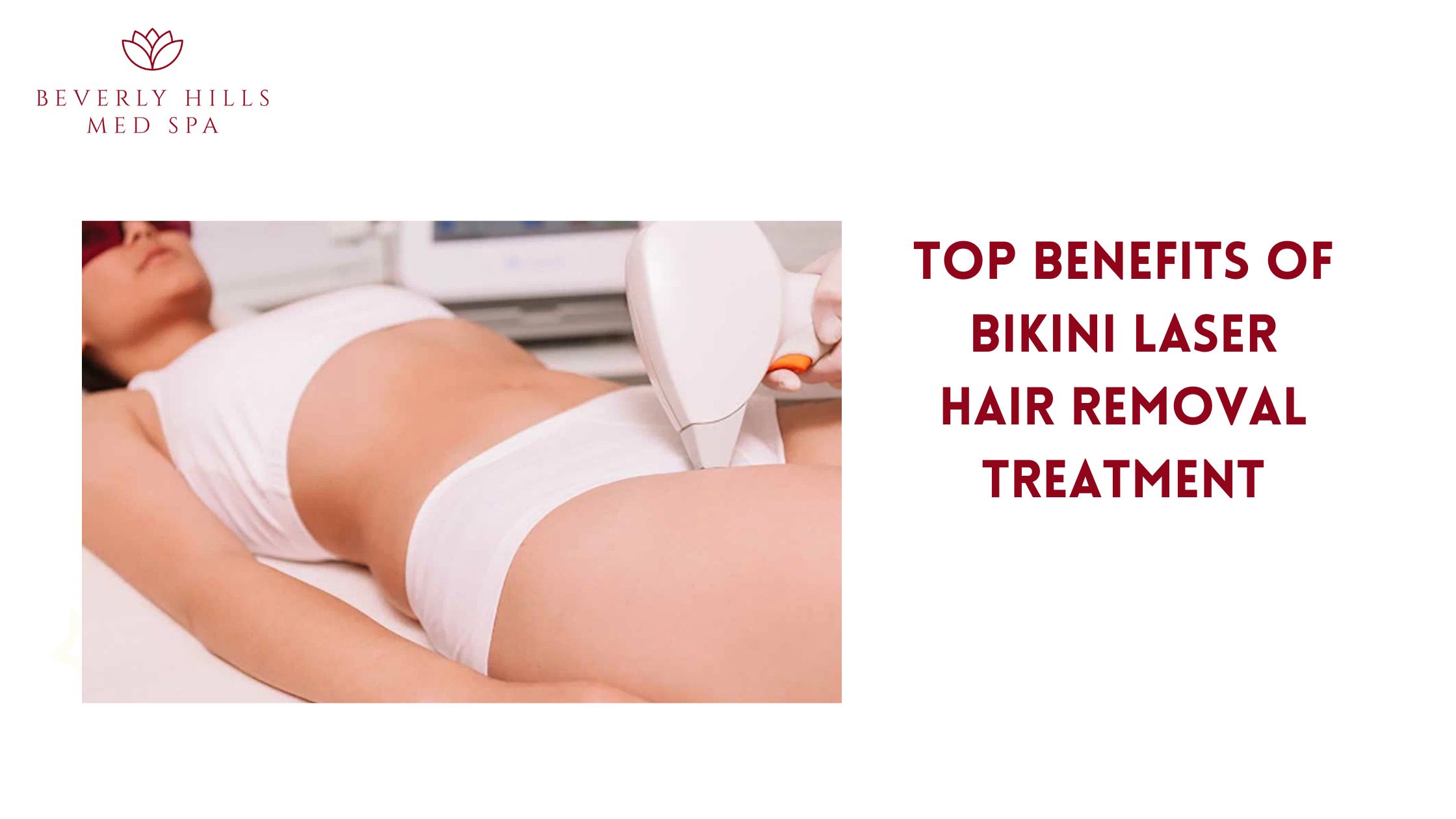 bikini laser hair removal