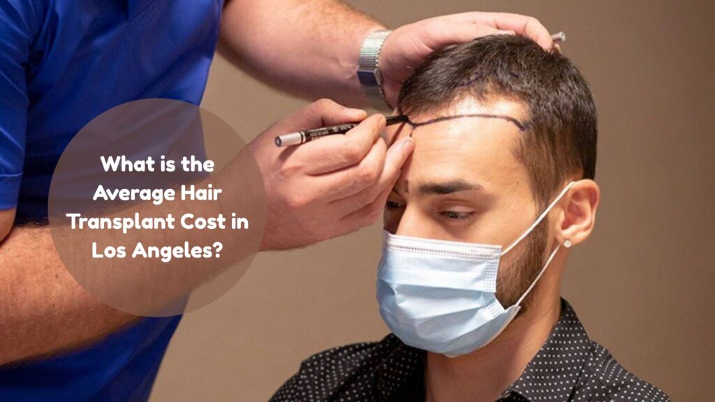 hair transplant cost los angeles