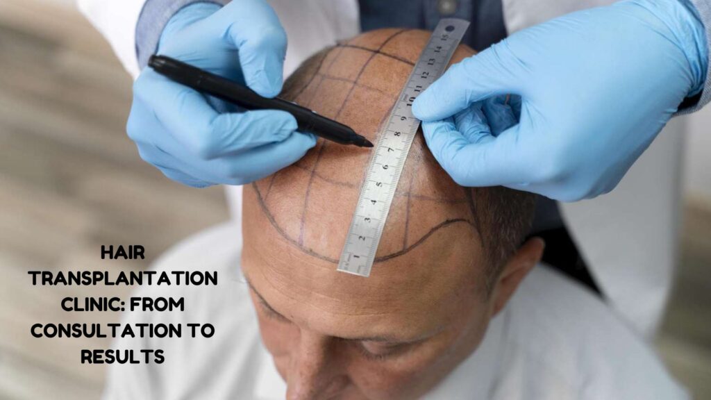 hair transplantation clinic