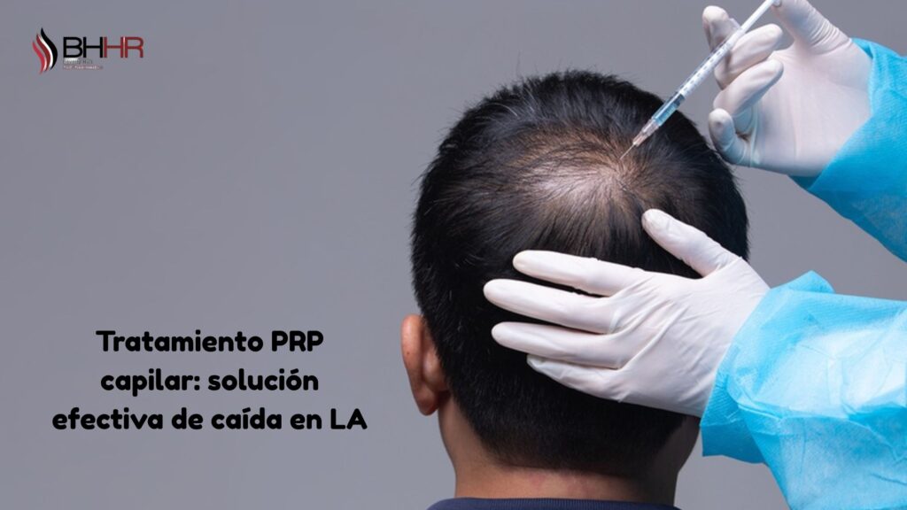 tratamiento prp capilar