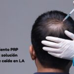 tratamiento prp capilar