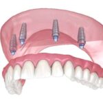 Dental Appointment