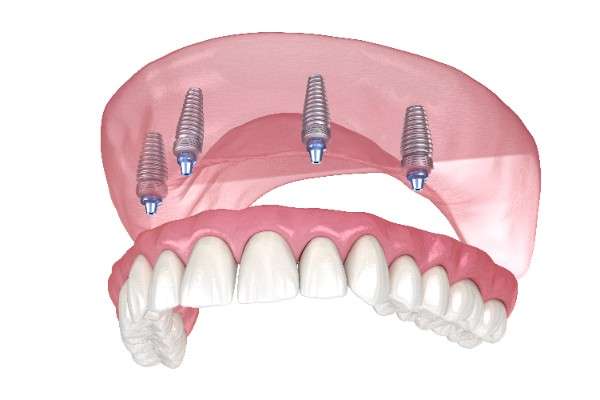 Dental Appointment